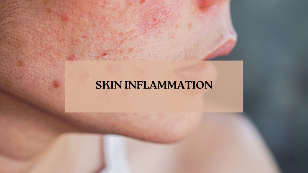 SKIN 101 – YUNIBA