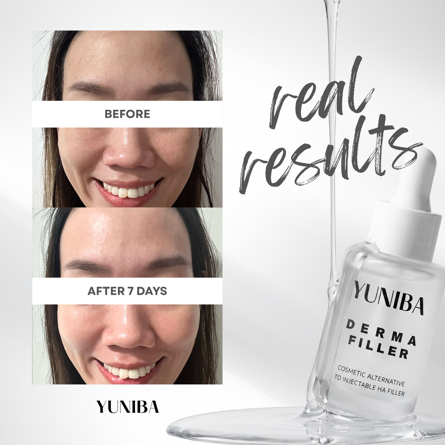 Derma Filler 30ML - Non-Invasive HA Filler for Instant Wrinkle Reduction & Skin Hydration