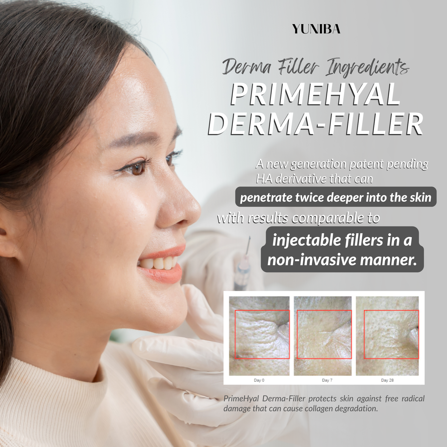 Derma Filler 30ML - Non-Invasive HA Filler for Instant Wrinkle Reduction & Skin Hydration