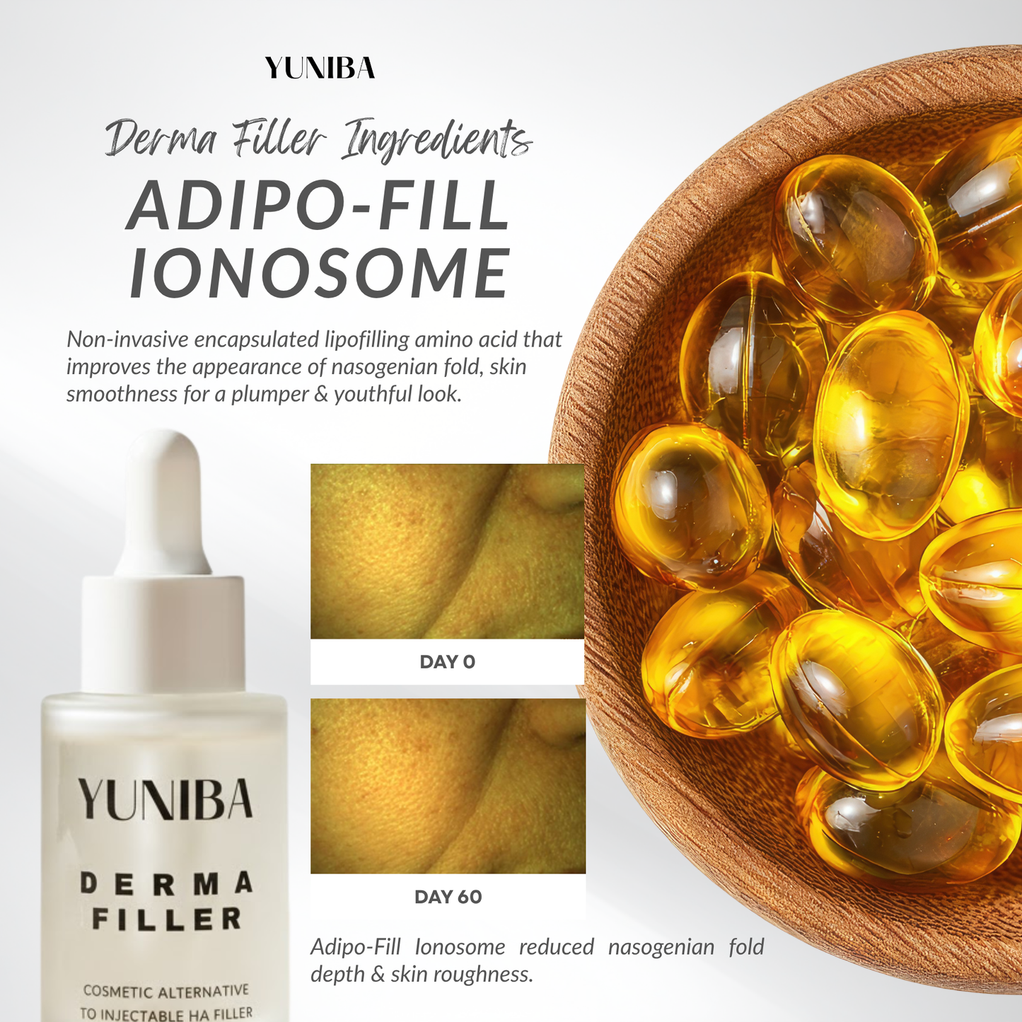 Derma Filler 30ML - Non-Invasive HA Filler for Instant Wrinkle Reduction & Skin Hydration